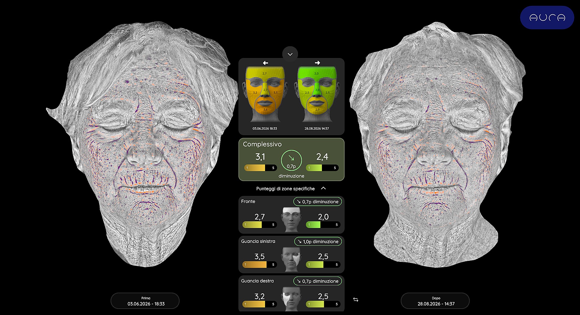 Fotoinvecchiamento, lassità e qualità cutanea — Analisi delle rughe (AURA)